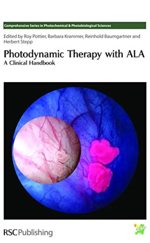 Photodynamic Therapy with ALA : A Clinical Handbook : Volume 7