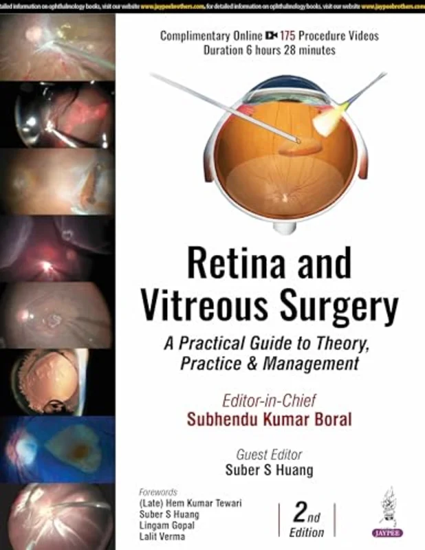 Retina and Vitreous Surgery : A Practical Guide to Theory, Practice & Management